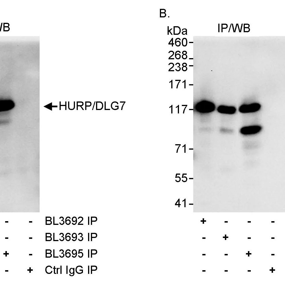 Rabbit anti-HURP/DLG7 Antibody, Affinity Purified