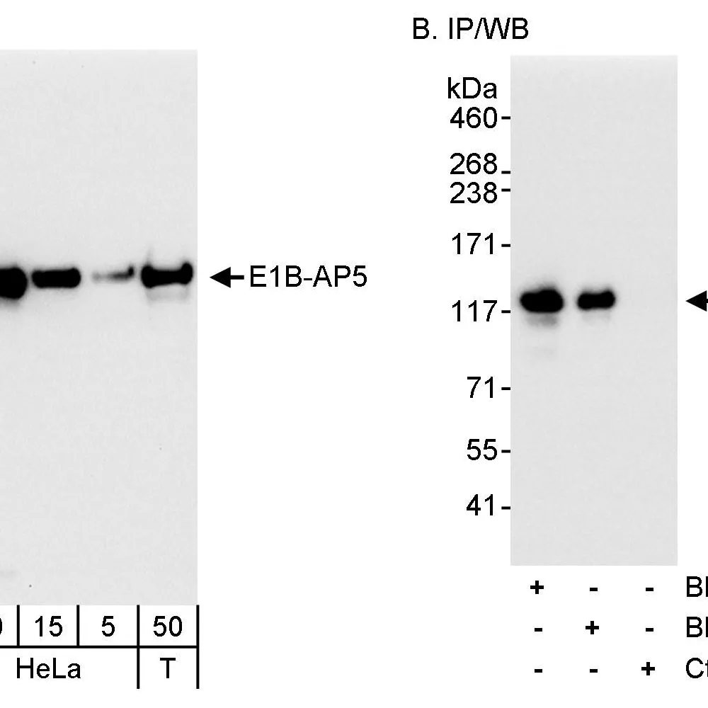 Rabbit anti-E1B-AP5 Antibody, Affinity Purified