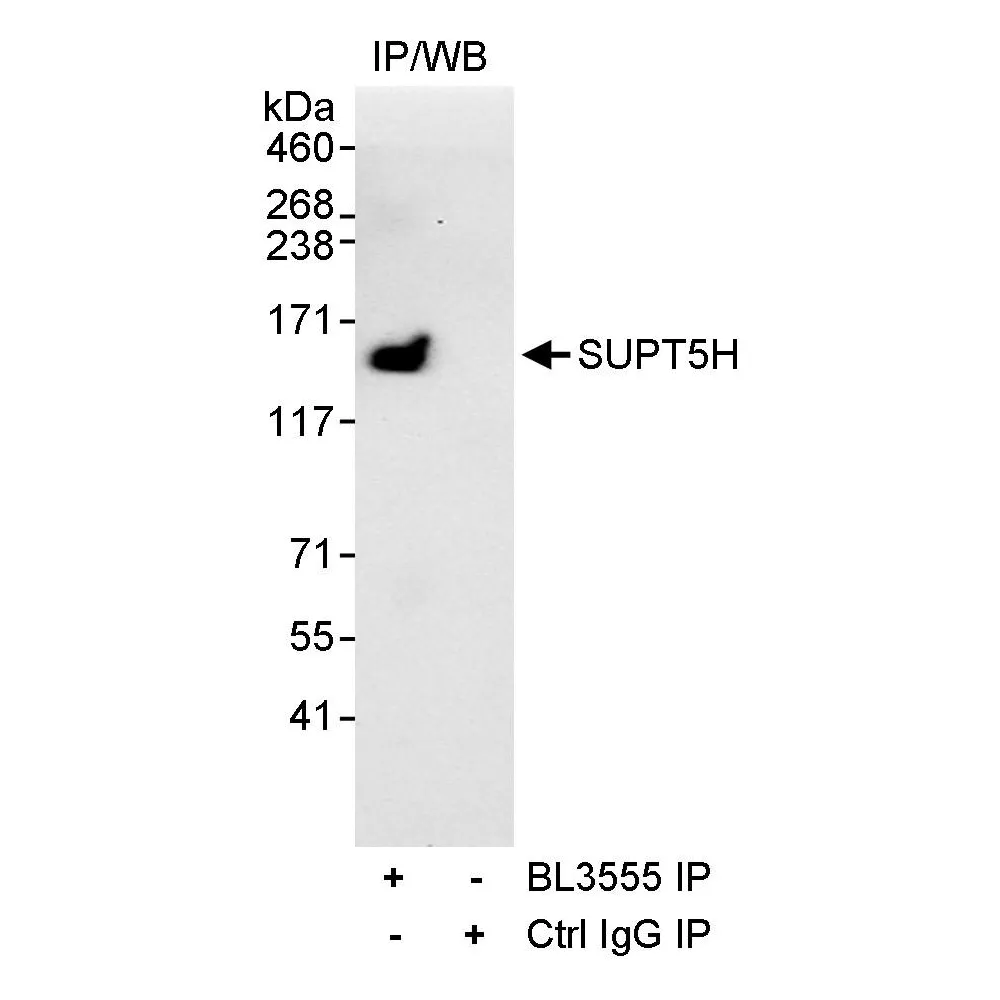 Rabbit anti-SUPT5H Antibody, Affinity Purified