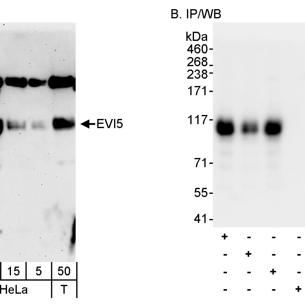 Rabbit anti-EVI5 Antibody, Affinity Purified