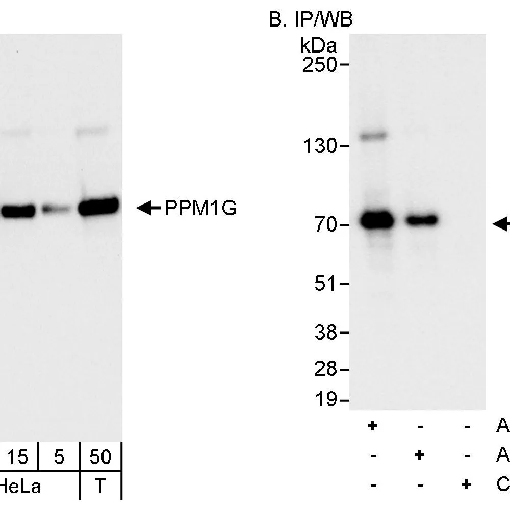 Rabbit anti-PPM1G Antibody, Affinity Purified
