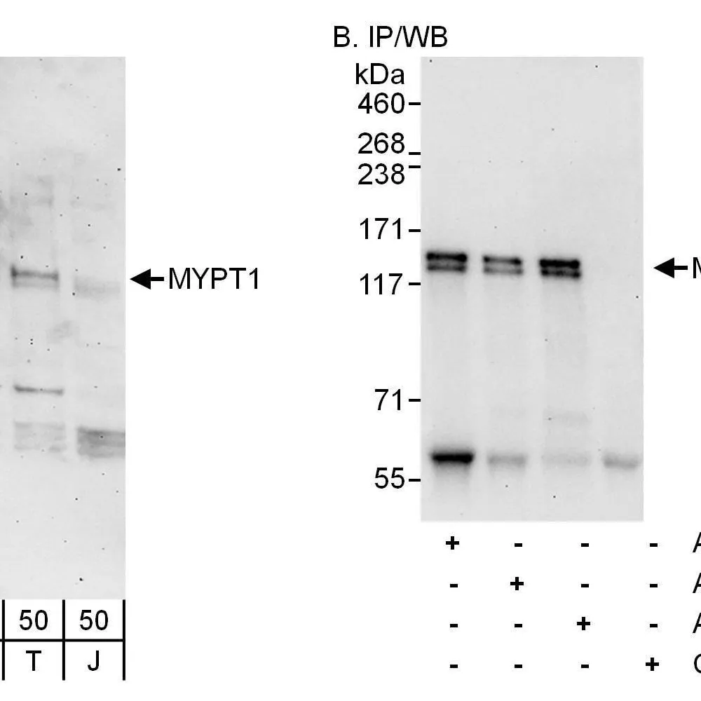 Rabbit anti-MYPT1 Antibody, Affinity Purified
