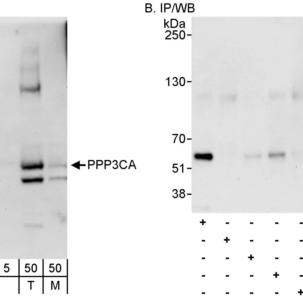 Rabbit anti-PPP3CA Antibody, Affinity Purified