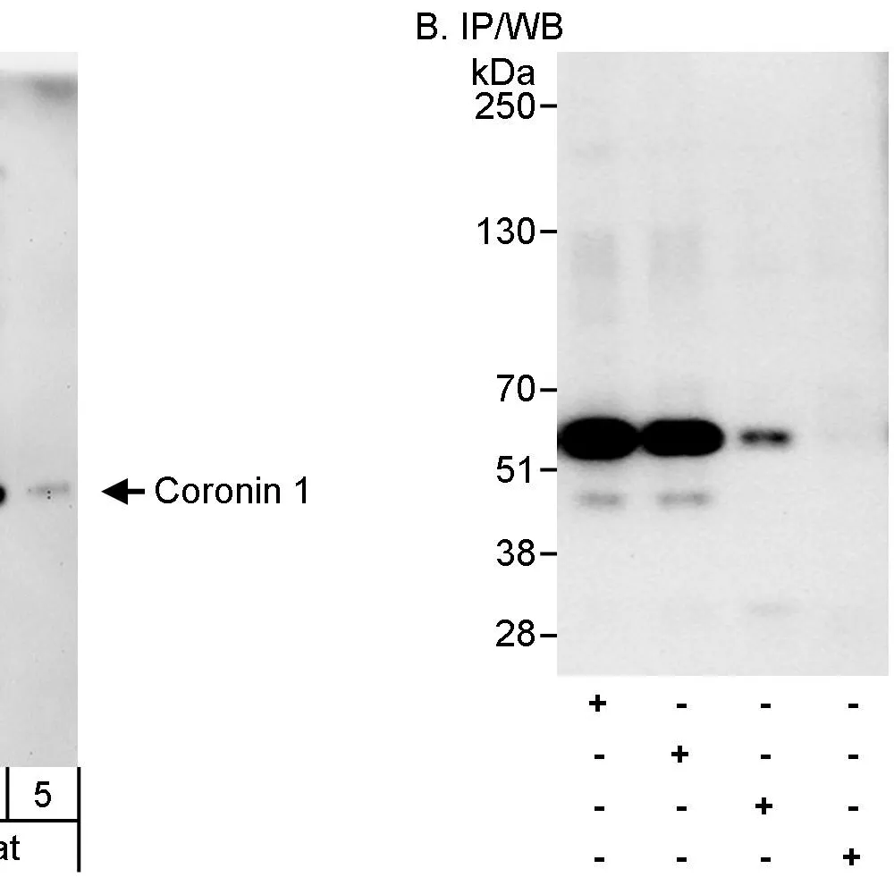 Rabbit anti-Coronin 1 Antibody, Affinity Purified