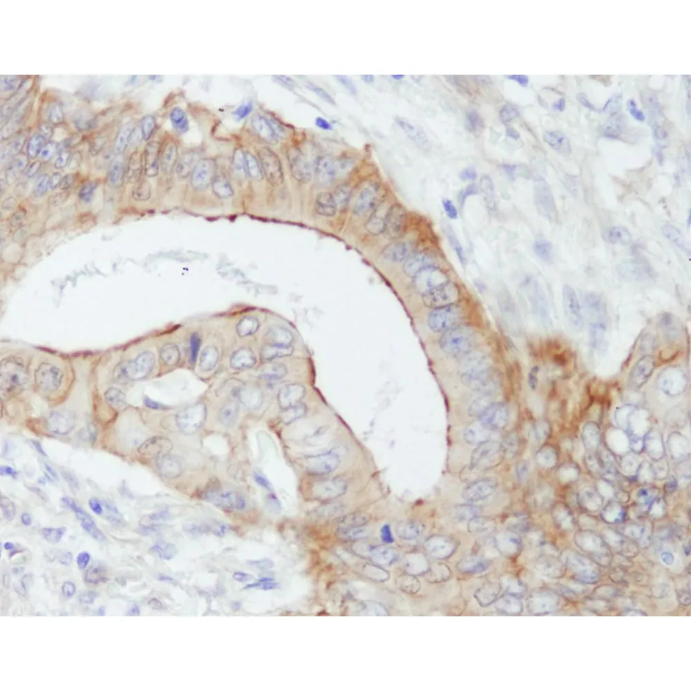 Rabbit anti-SPTBN1 Antibody, Affinity Purified