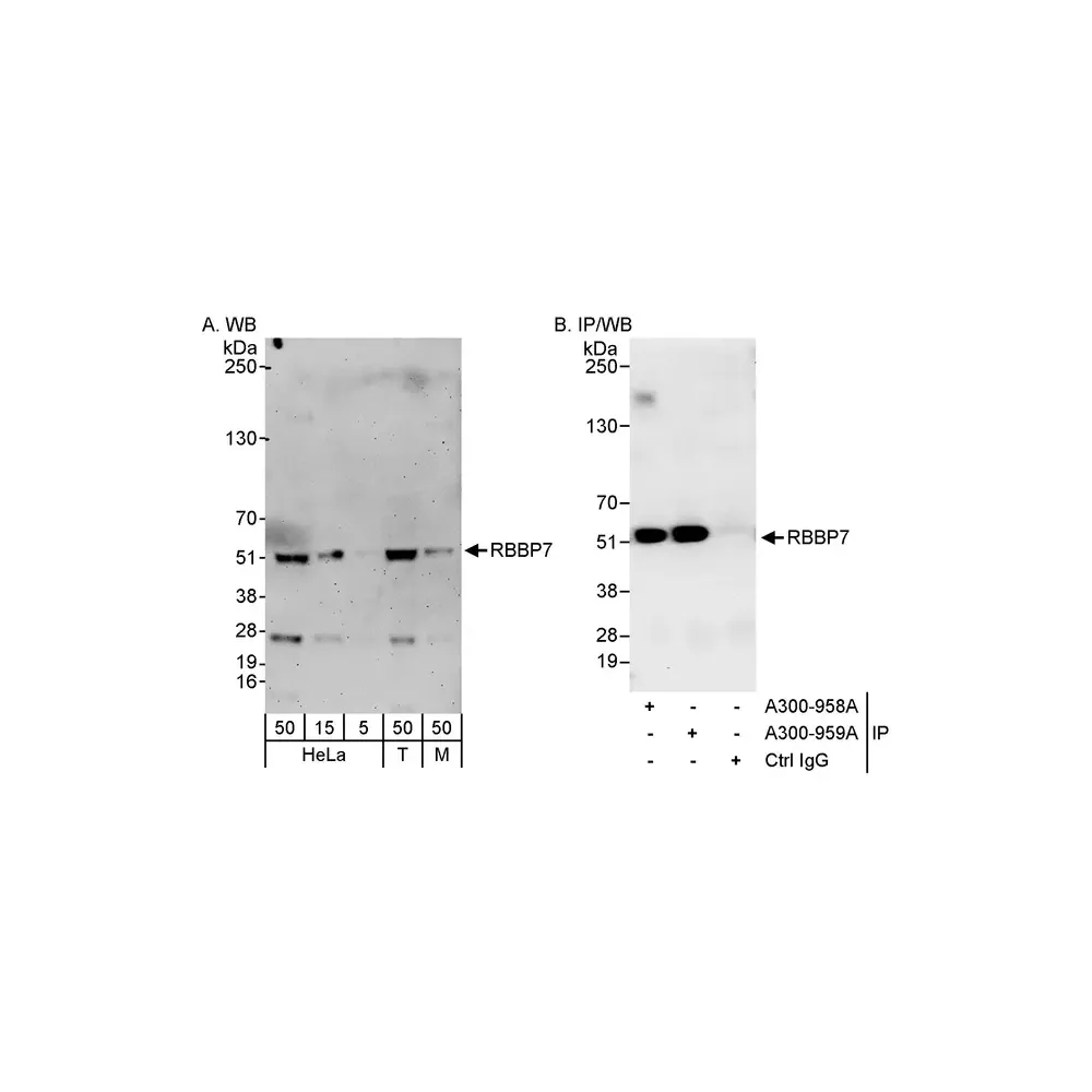 Rabbit anti-RbBP7 Antibody, Affinity Purified