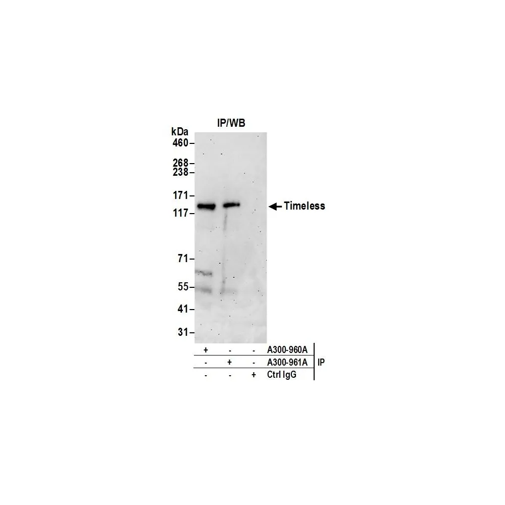 Rabbit anti-Timeless Antibody, Affinity Purified