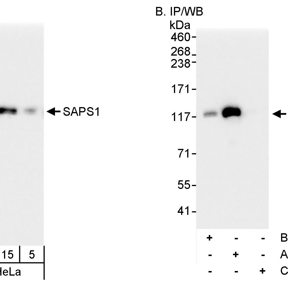Rabbit anti-SAPS1 Antibody, Affinity Purified