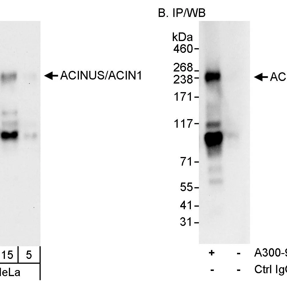 Rabbit anti-ACINUS/ACN1 Antibody, Affinity Purified