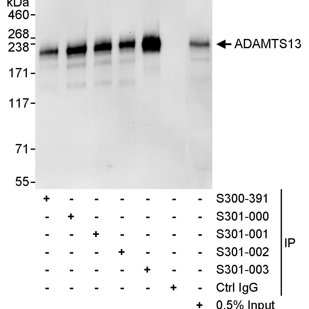 Goat anti-ADAMTS13 Antibody, Affinity Purified