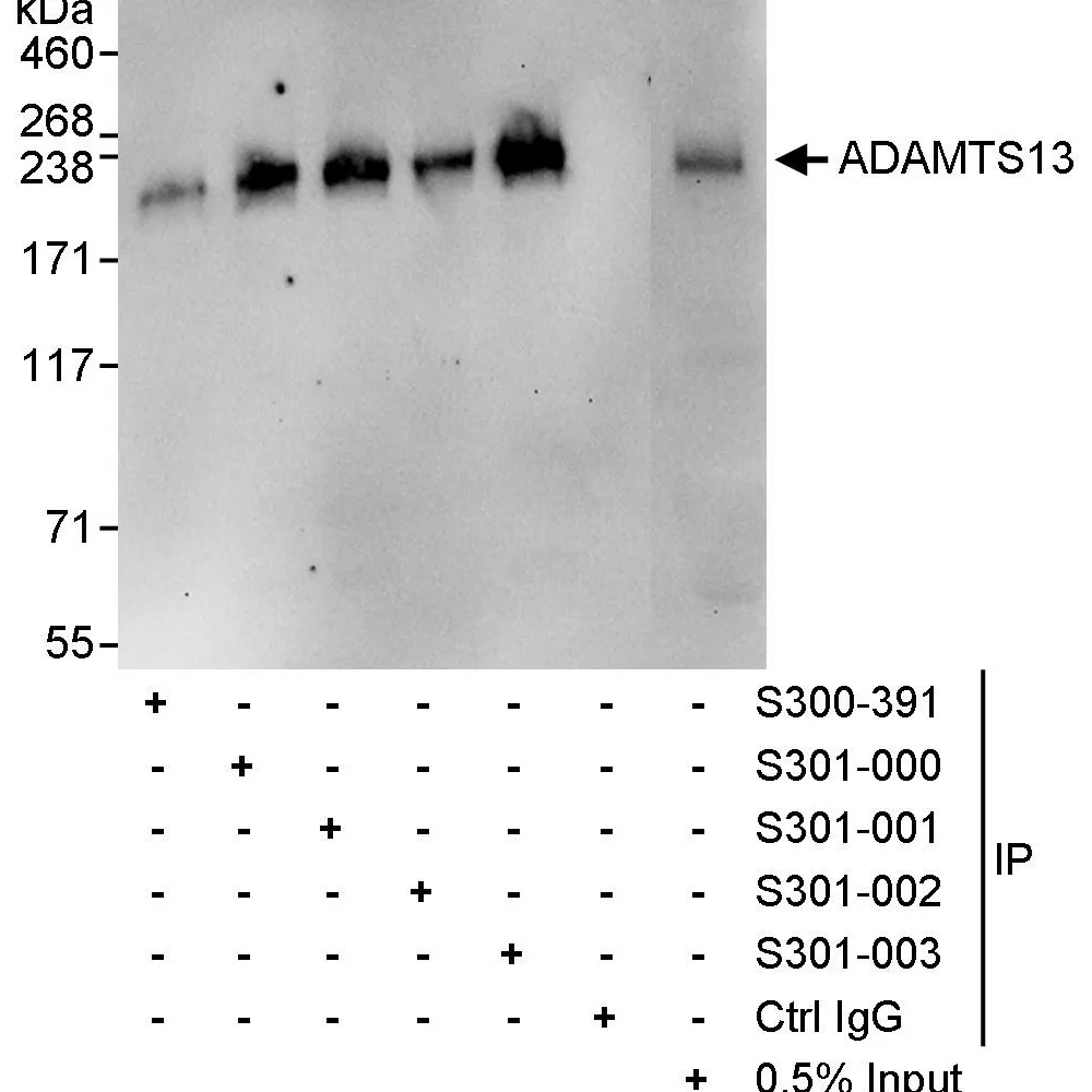 Goat anti-ADAMTS13 Antibody, Affinity Purified
