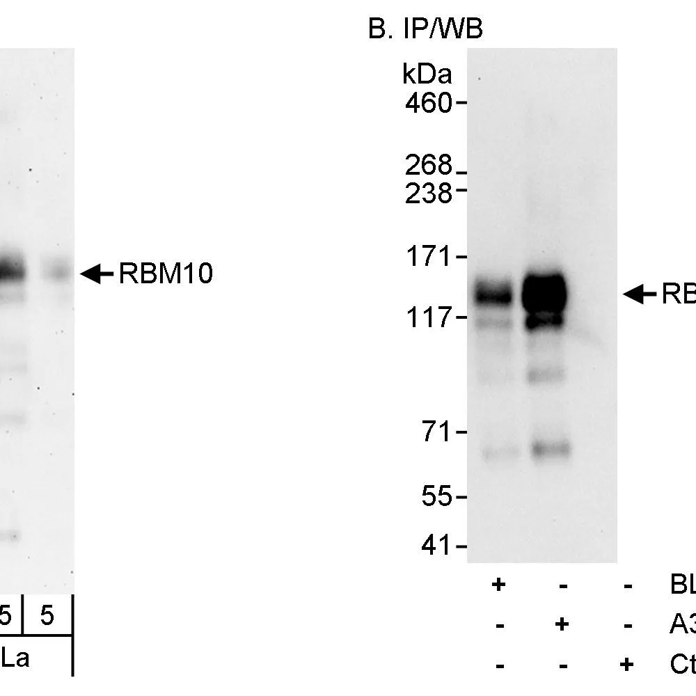 Rabbit anti-RBM10 Antibody, Affinity Purified