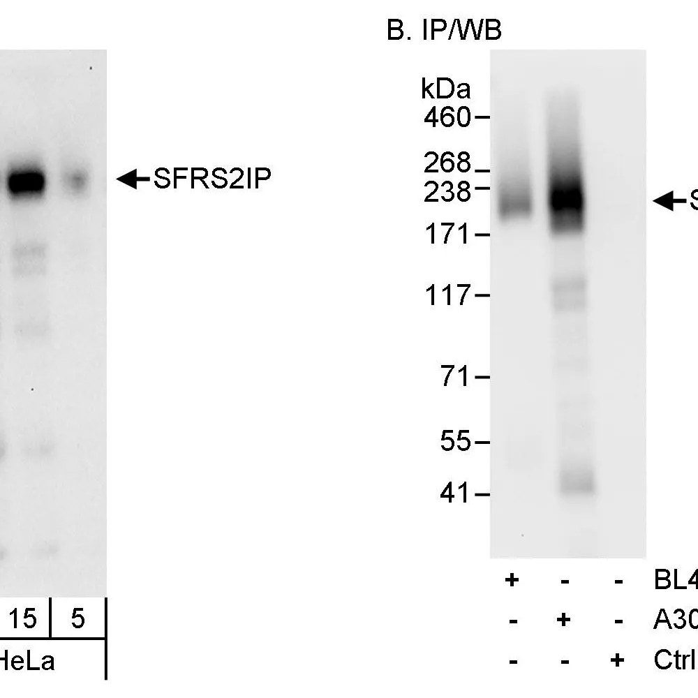 Rabbit anti-SFRS2IP Antibody, Affinity Purified