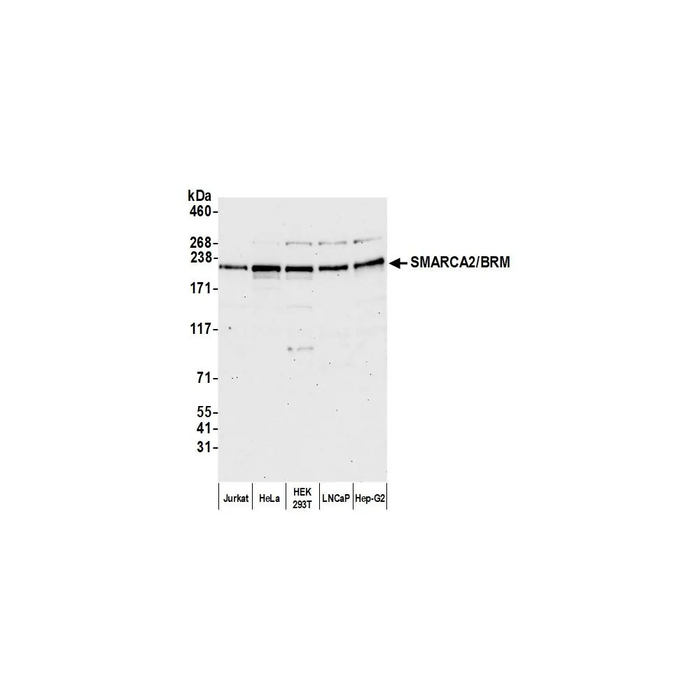 Rabbit anti-SMARCA2/BRM Antibody, Affinity Purified