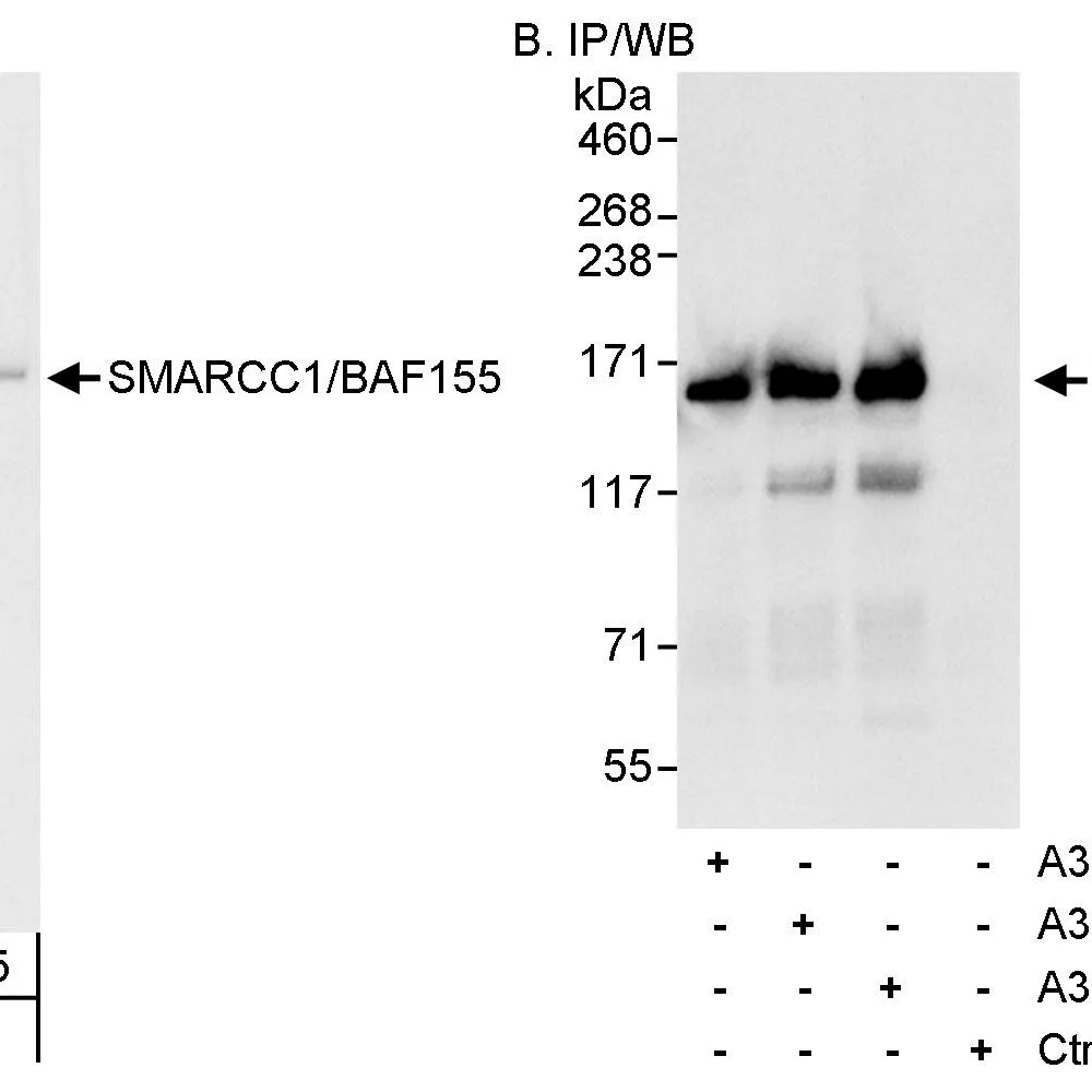 Rabbit anti-SMARCC1/BAF155 Antibody, Affinity Purified