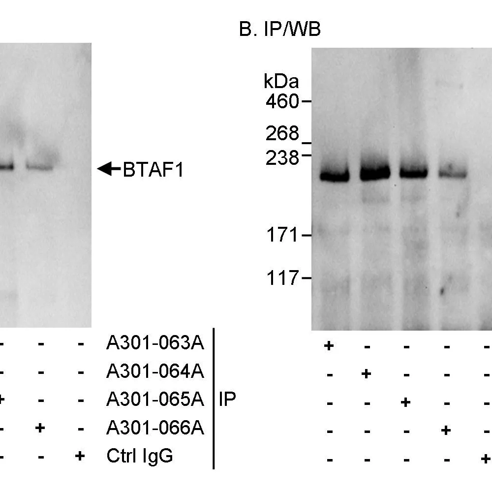 Rabbit anti-BTAF1 Antibody, Affinity Purified