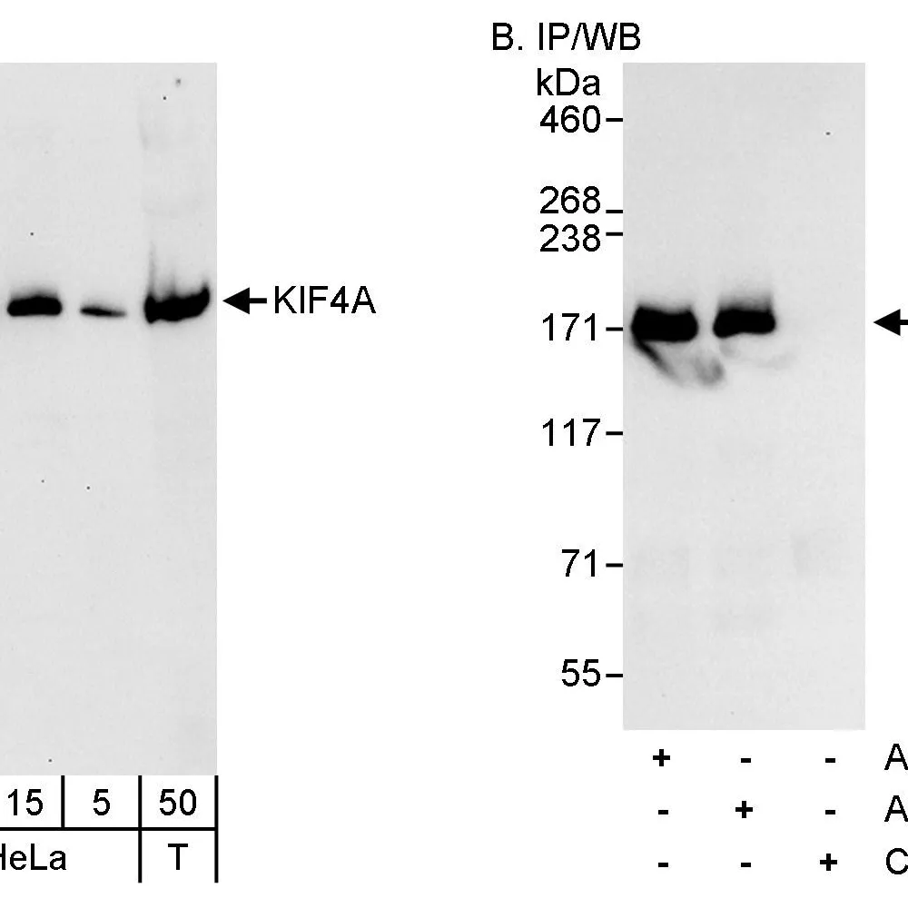 Rabbit anti-KIF4A Antibody, Affinity Purified