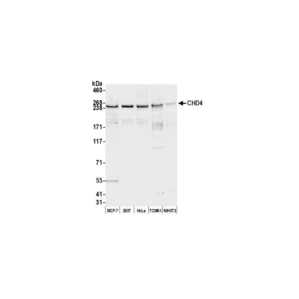 Rabbit anti-CHD4 Antibody, Affinity Purified