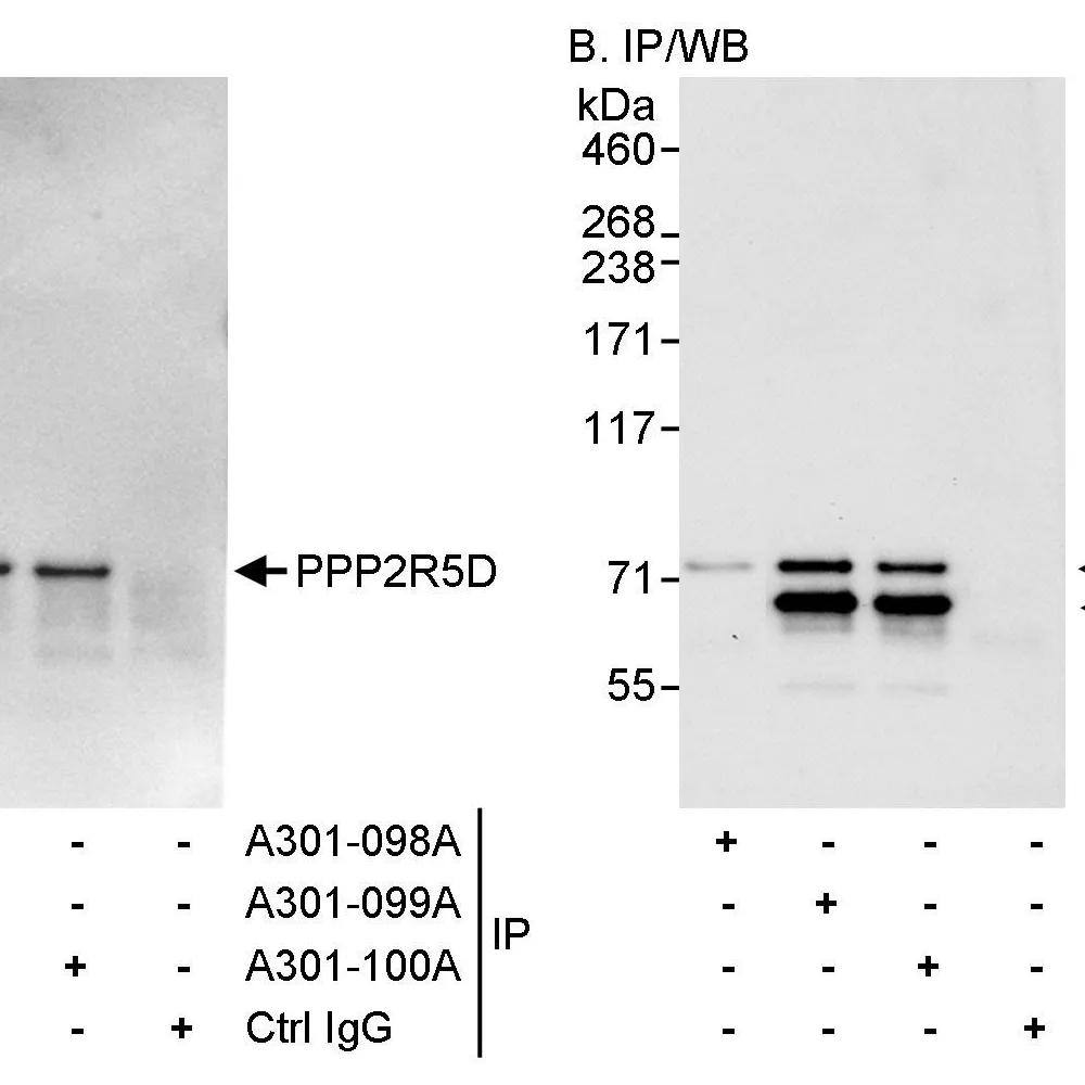 Rabbit anti-PPP2R5D Antibody, Affinity Purified