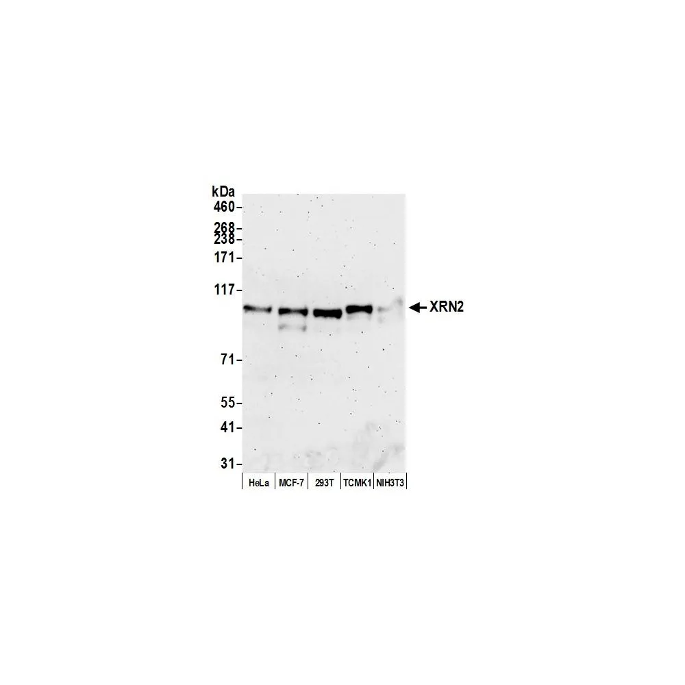 Rabbit anti-XRN2 Antibody, Affinity Purified