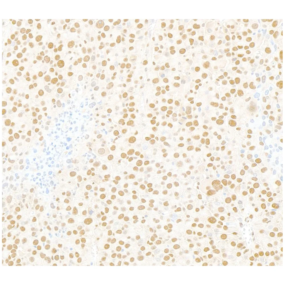 Rabbit anti-XRN2 Antibody, Affinity Purified