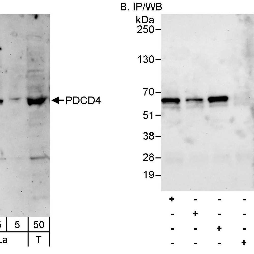 Rabbit anti-PDCD4 Antibody, Affinity Purified