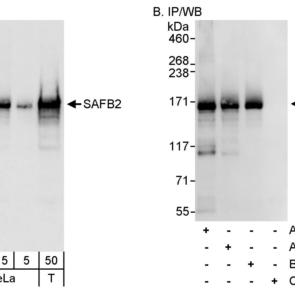 Rabbit anti-SAFB2 Antibody, Affinity Purified