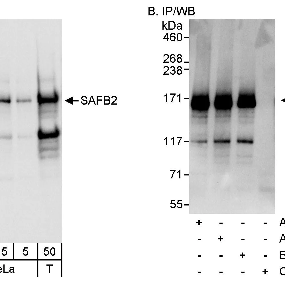 Rabbit anti-SAFB2 Antibody, Affinity Purified