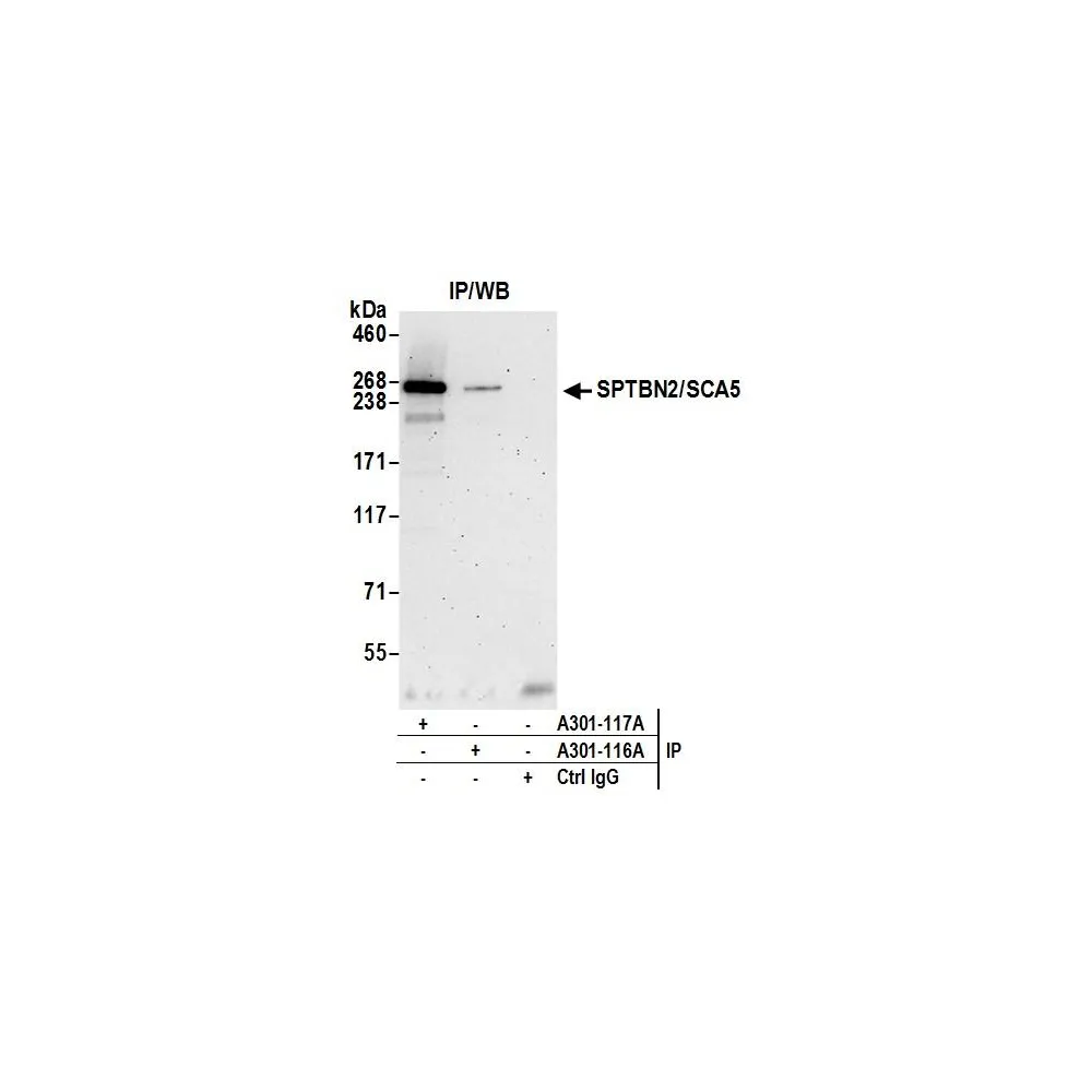 Rabbit anti-SPTBN2/SCA5 Antibody, Affinity Purified