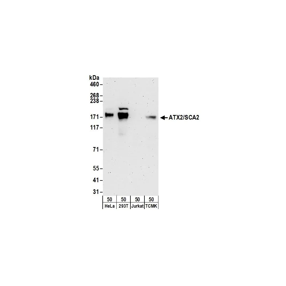 Rabbit anti-ATX2/SCA2 Antibody, Affinity Purified