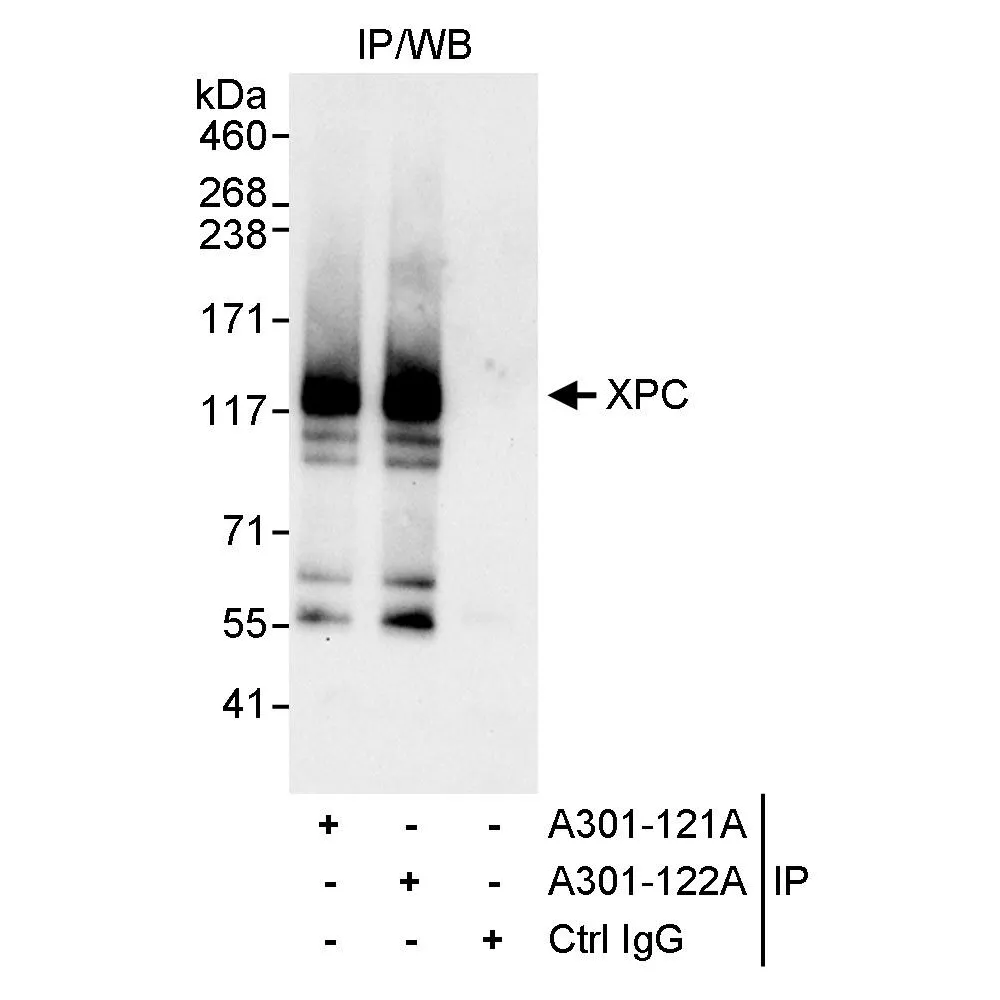 Rabbit anti-XPC Antibody, Affinity Purified