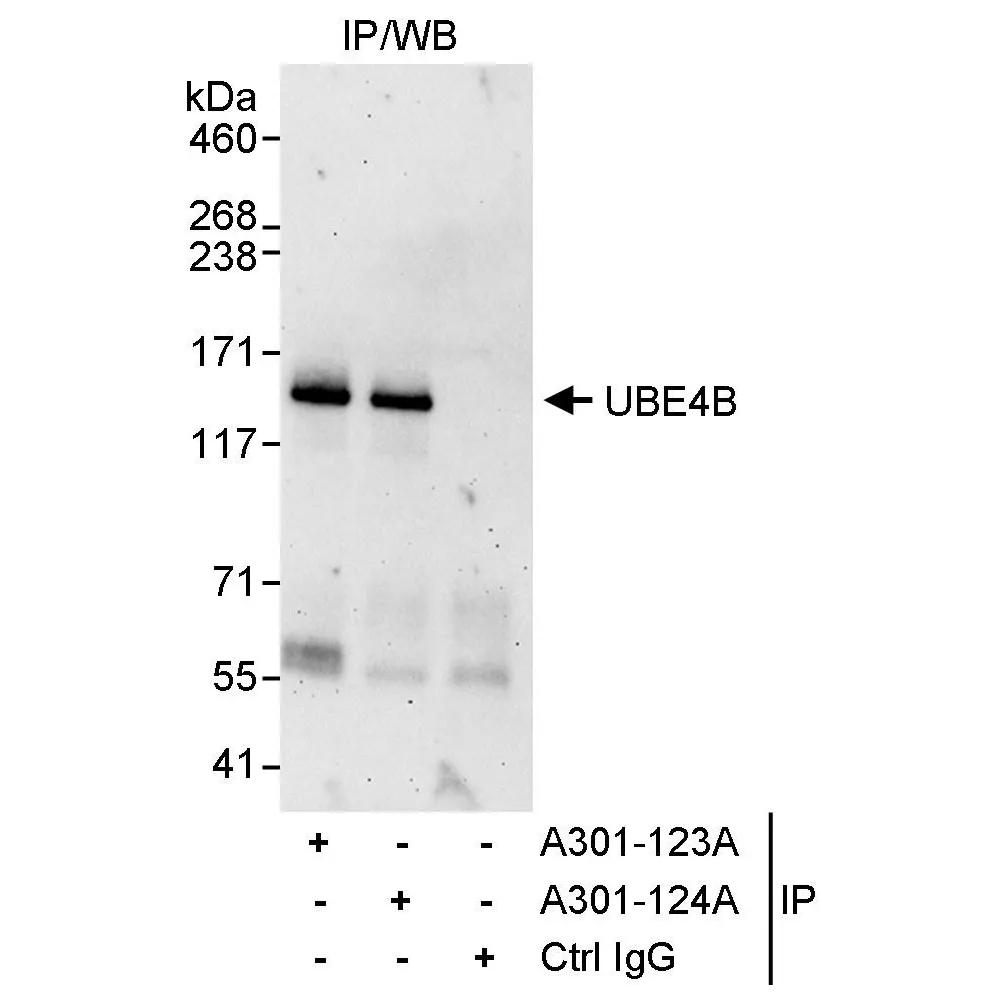 Rabbit anti-UBE4B Antibody, Affinity Purified