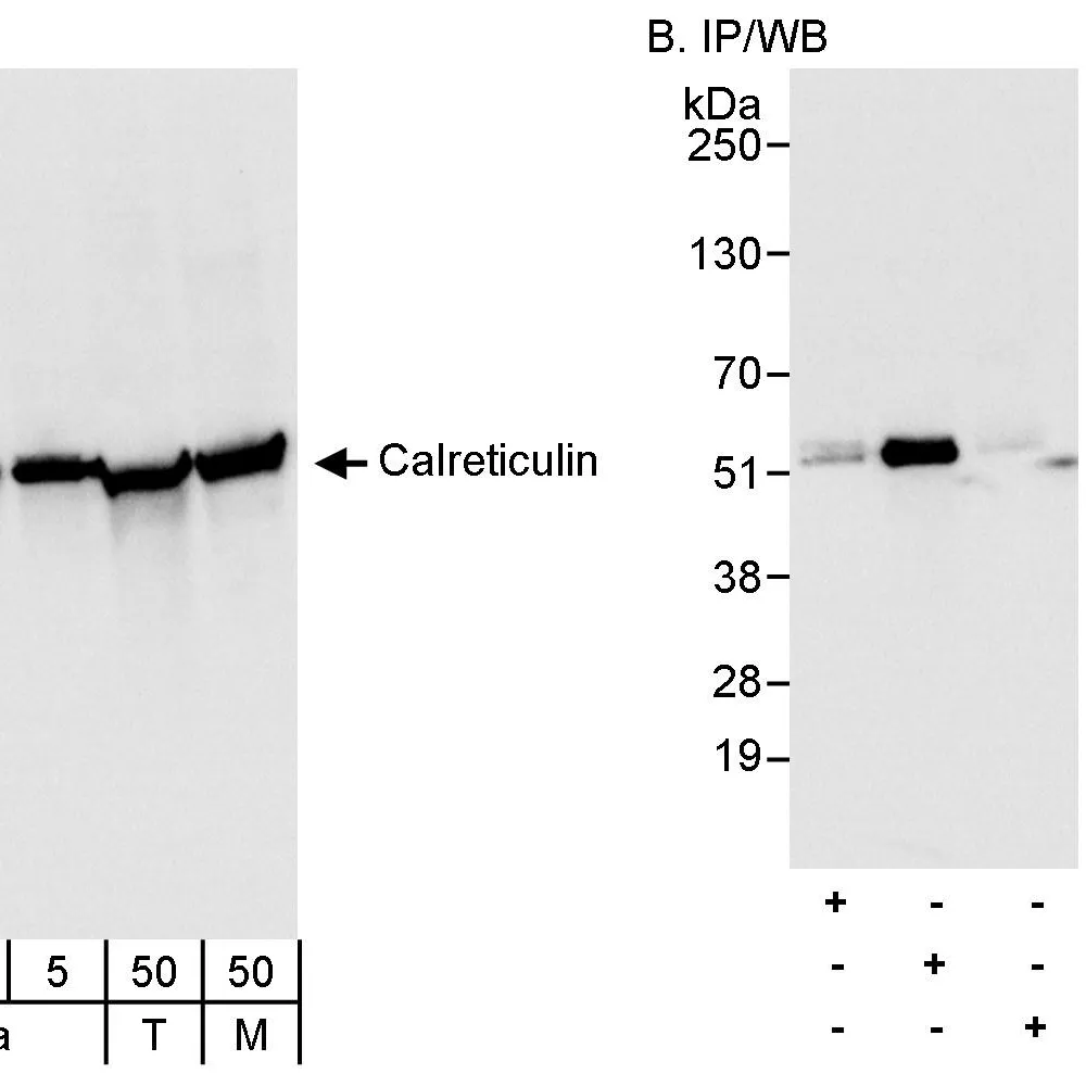 Rabbit anti-Calreticulin Antibody, Affinity Purified