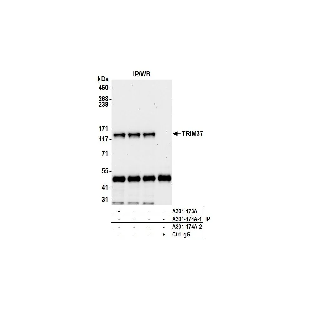 Rabbit anti-TRIM37 Antibody, Affinity Purified
