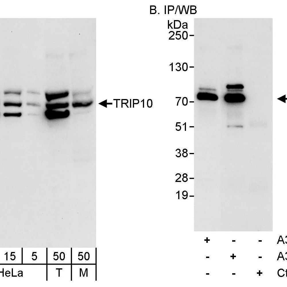 Rabbit anti-TRIP10/CIP4 Antibody, Affinity Purified