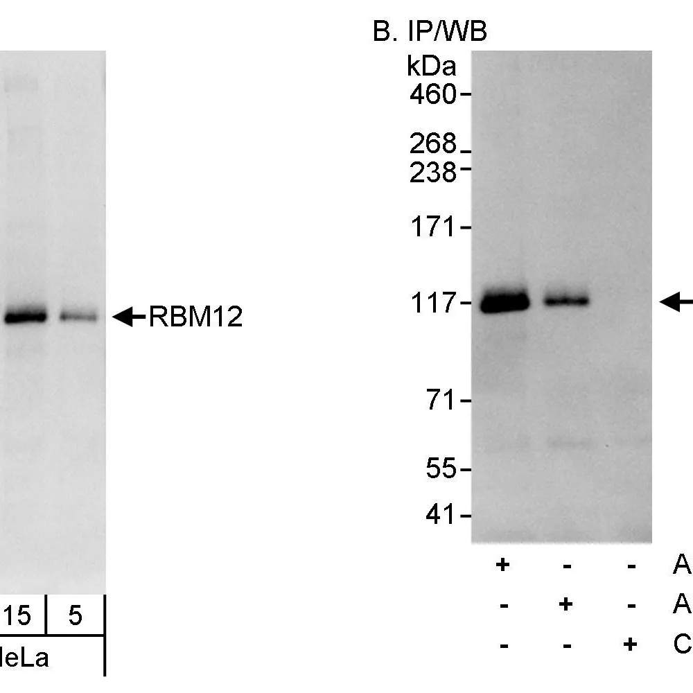 Rabbit anti-RBM12 Antibody, Affinity Purified