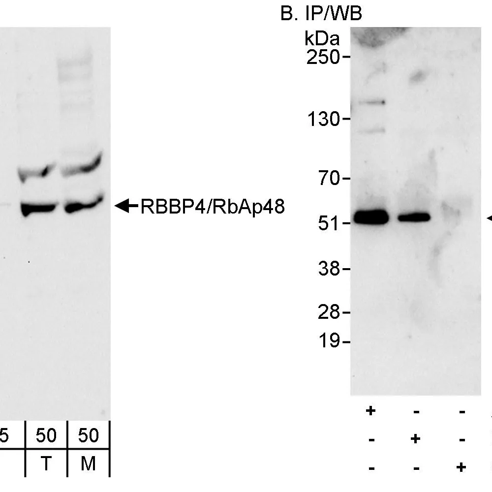 Rabbit anti-RbBP4 Antibody, Affinity Purified