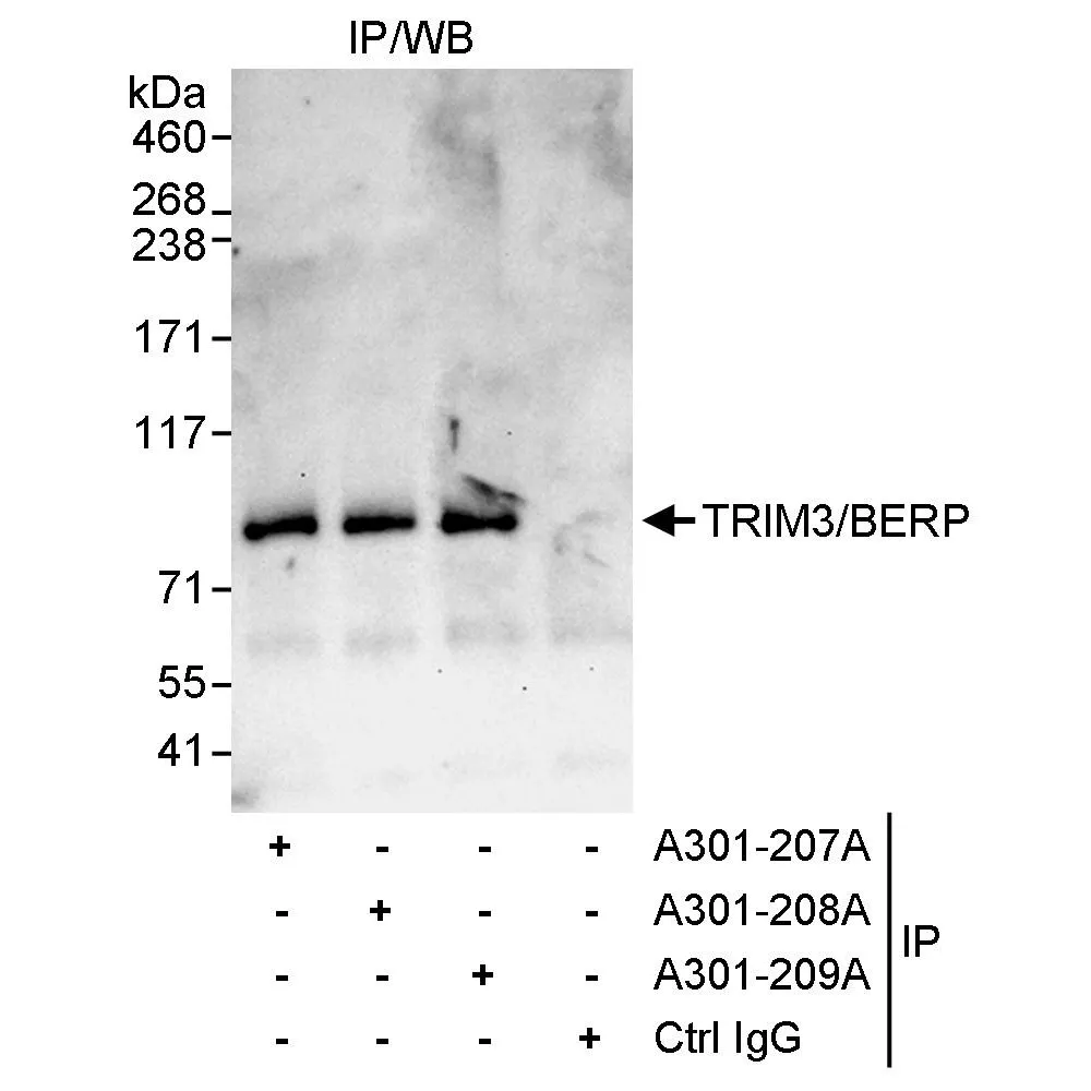 Rabbit anti-TRIM3/BERP Antibody, Affinity Purified
