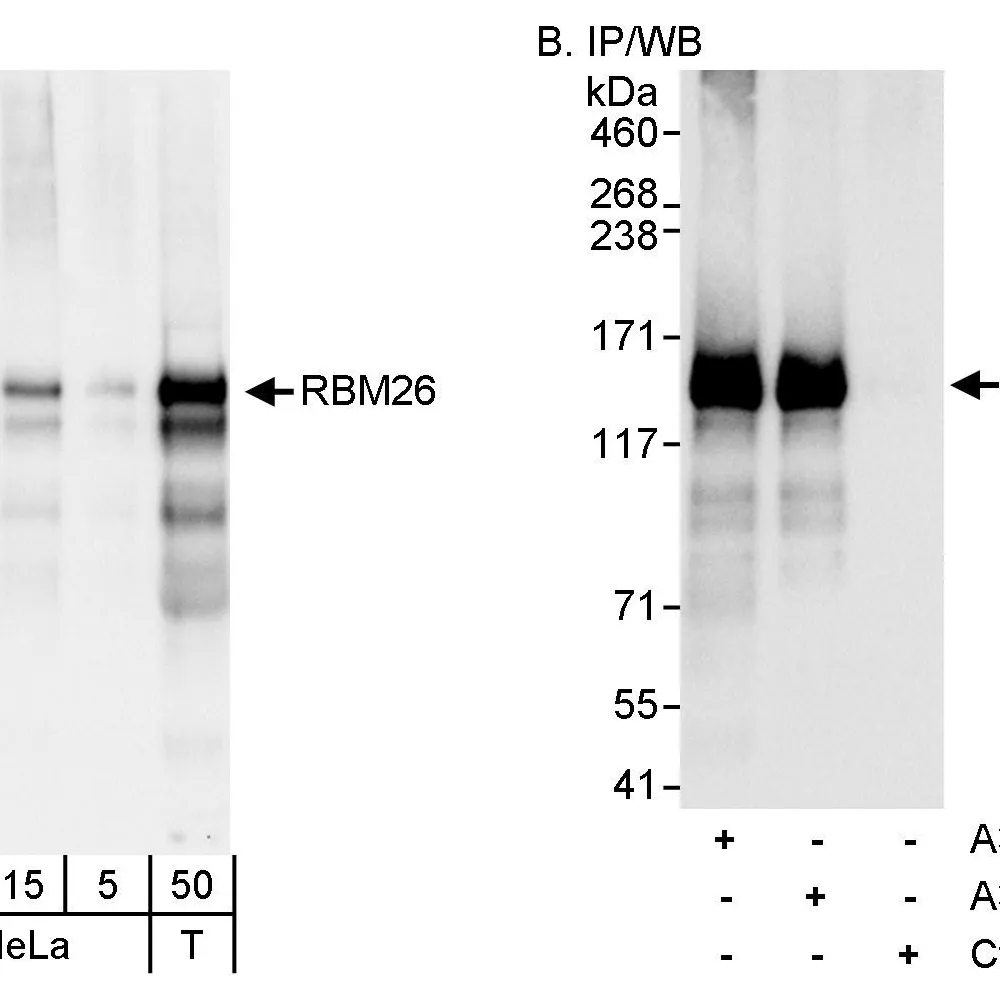 Rabbit anti-RBM26 Antibody, Affinity Purified