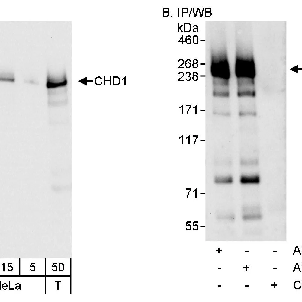 Rabbit anti-CHD1 Antibody, Affinity Purified