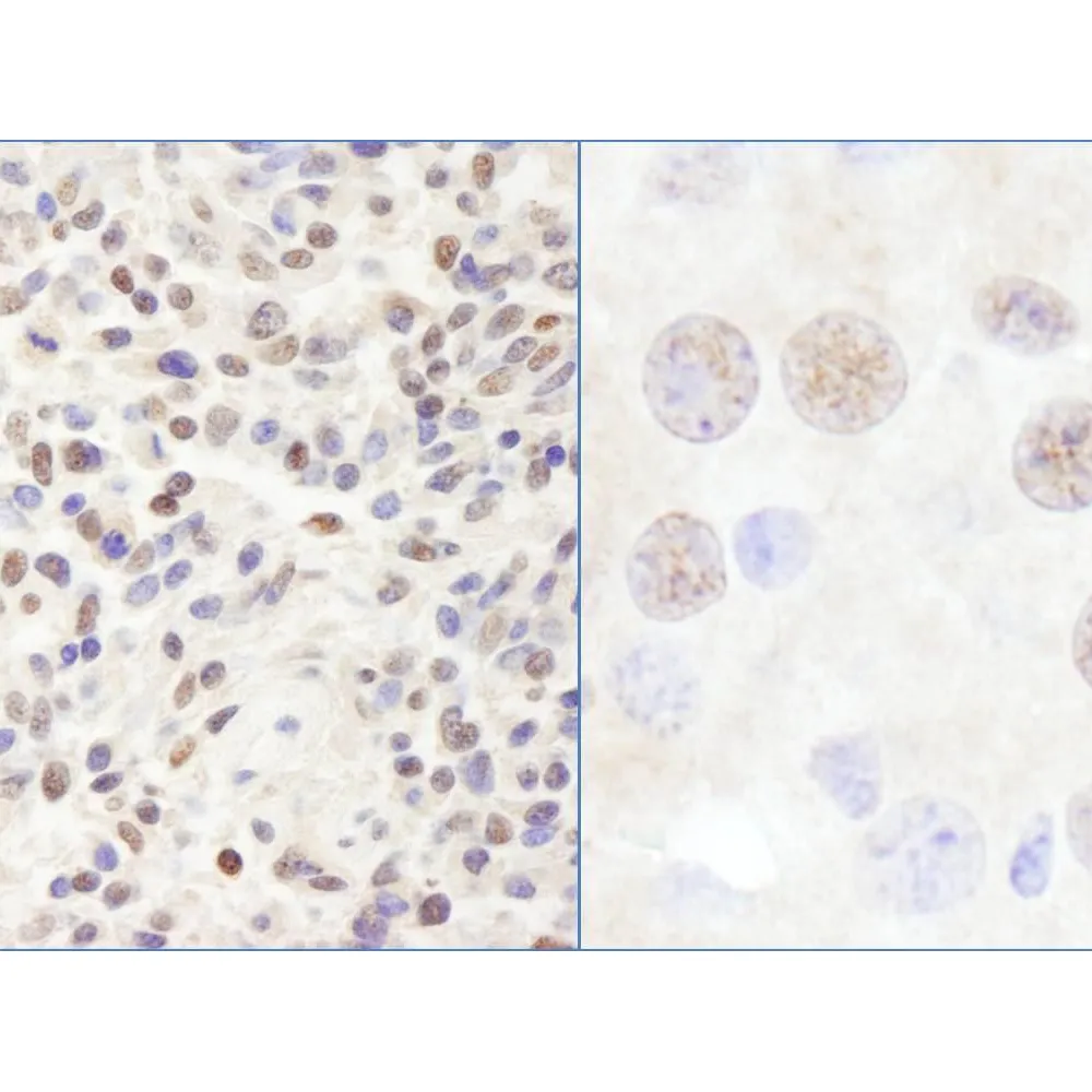 Rabbit anti-CHD3 Antibody, Affinity Purified
