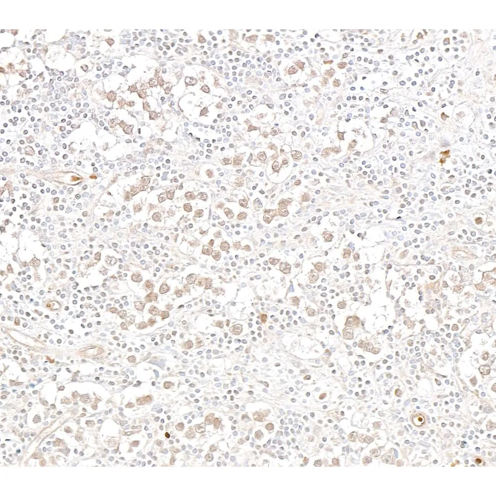 Rabbit anti-GTF3C3/TFIIIC102 Antibody, Affinity Purified