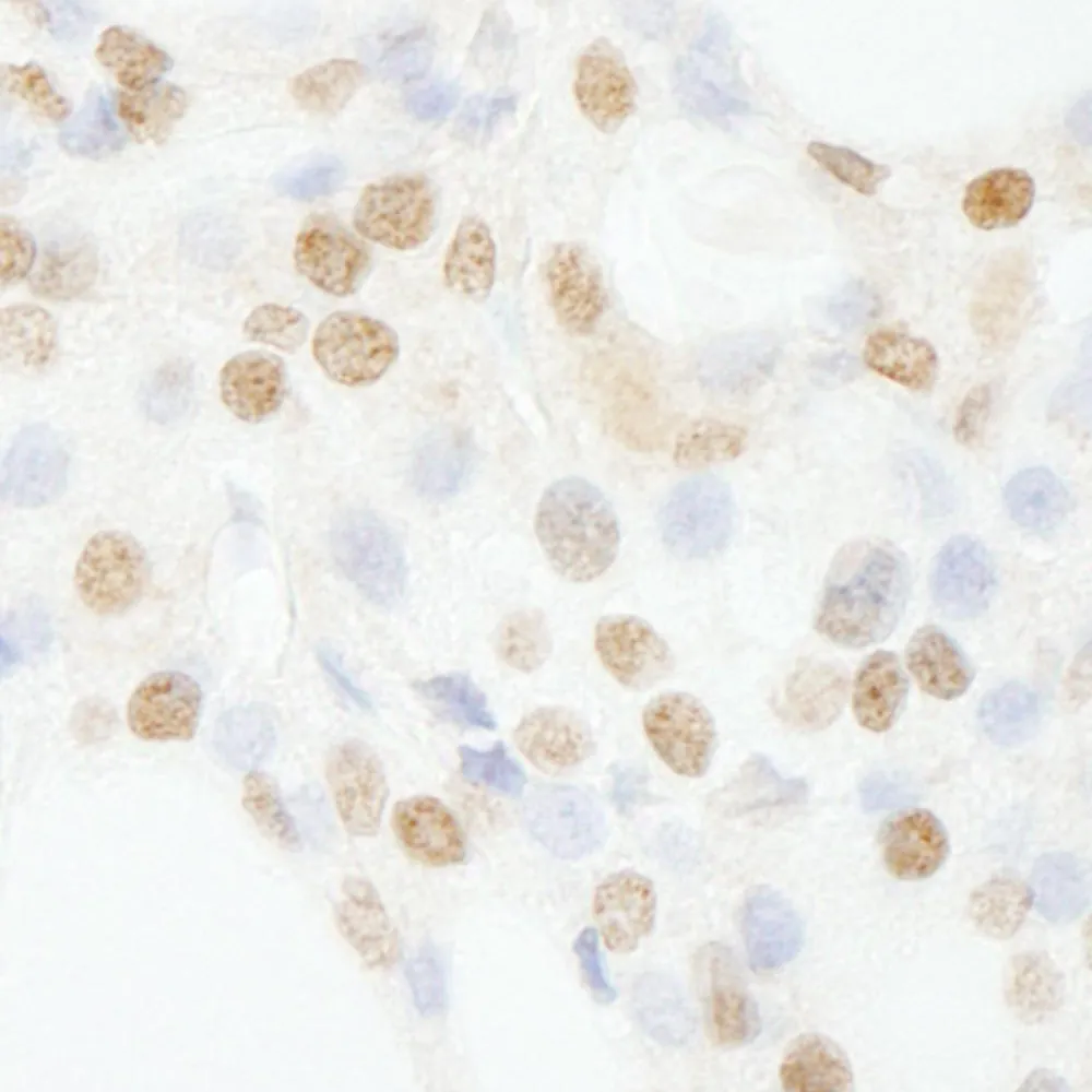 Rabbit anti-GTF3C4/TFIIIC90 Antibody, Affinity Purified