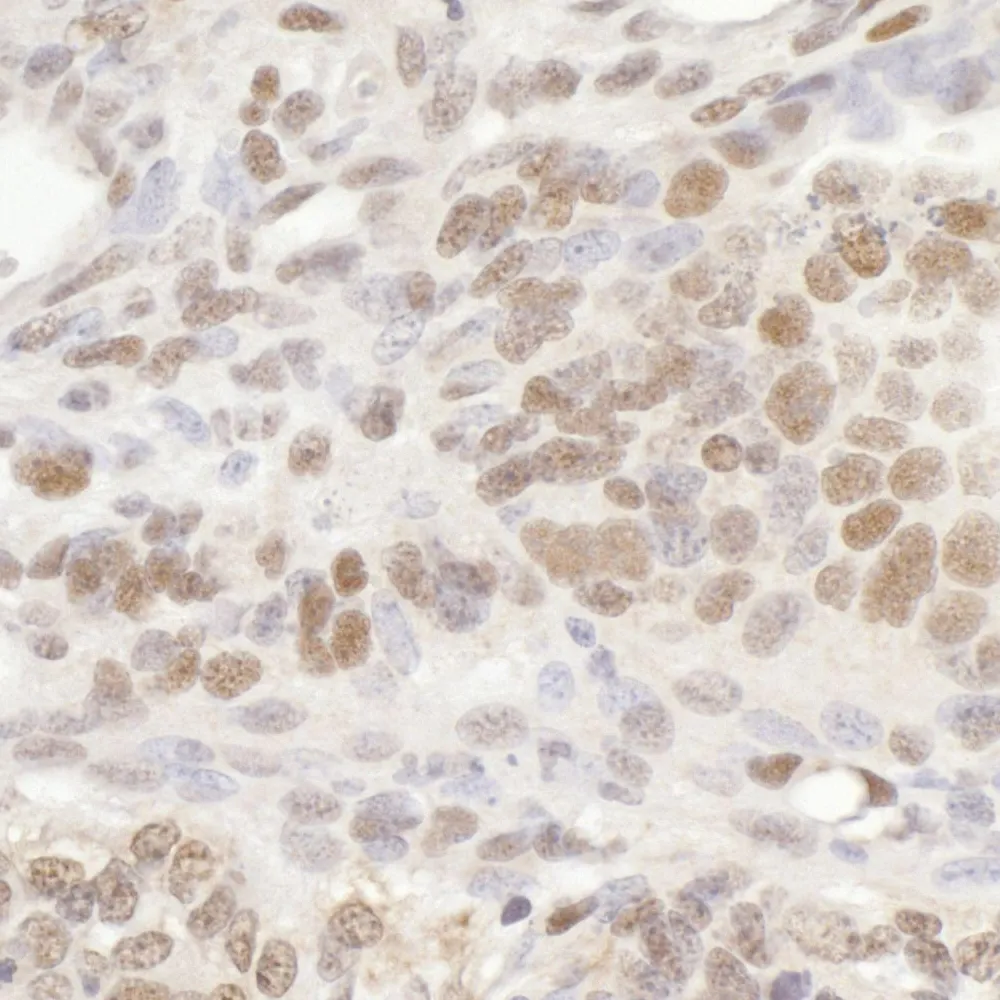 Rabbit anti-GTF3C5/TFIIIC63 Antibody, Affinity Purified