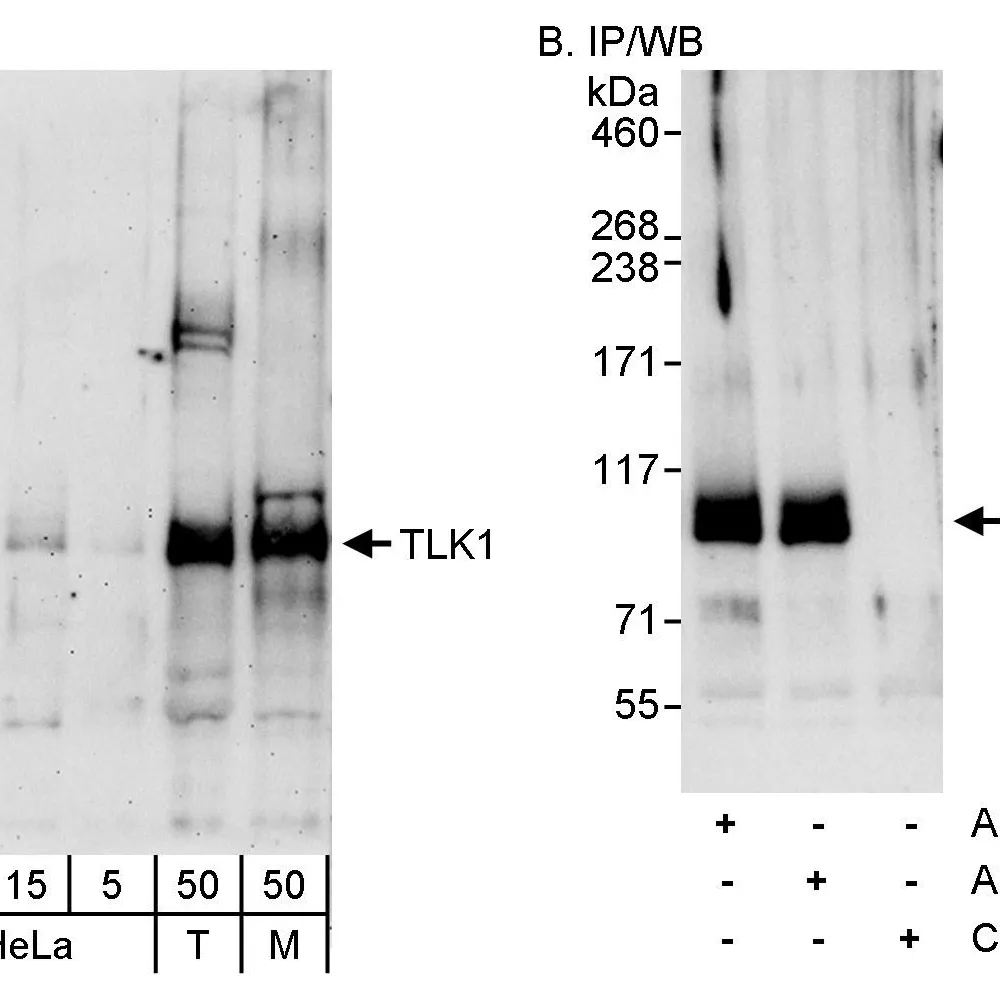 Rabbit anti-TLK1 Antibody, Affinity Purified