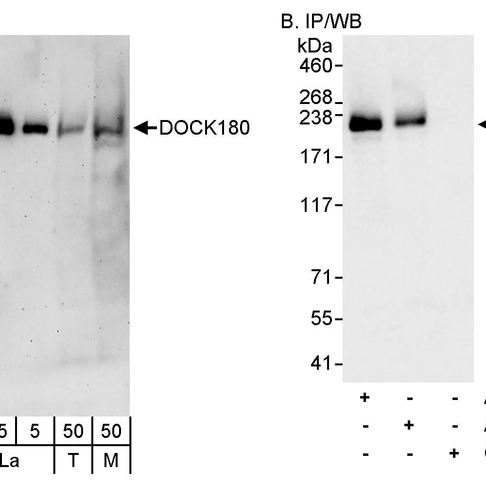 Rabbit anti-DOCK180 Antibody, Affinity Purified