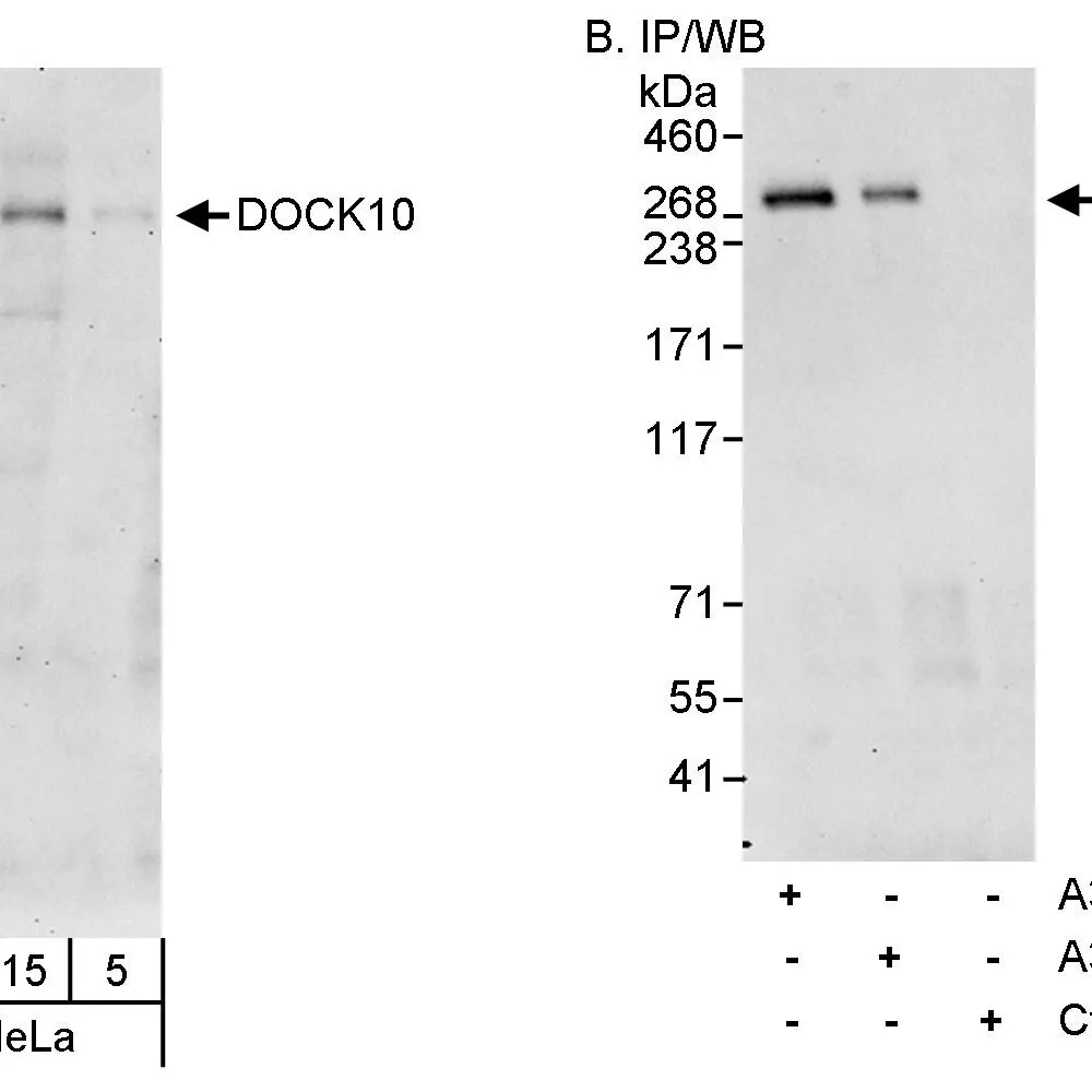 Rabbit anti-DOCK10 Antibody, Affinity Purified
