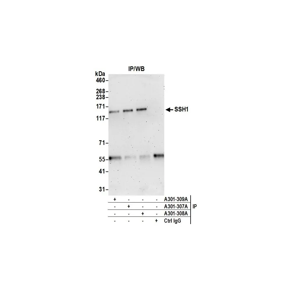 Rabbit anti-SSH1 Antibody, Affinity Purified