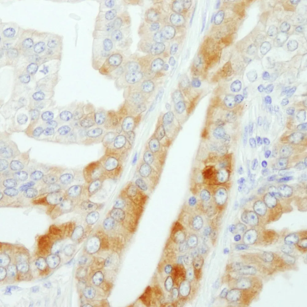 Rabbit anti-FASN Antibody, Affinity Purified