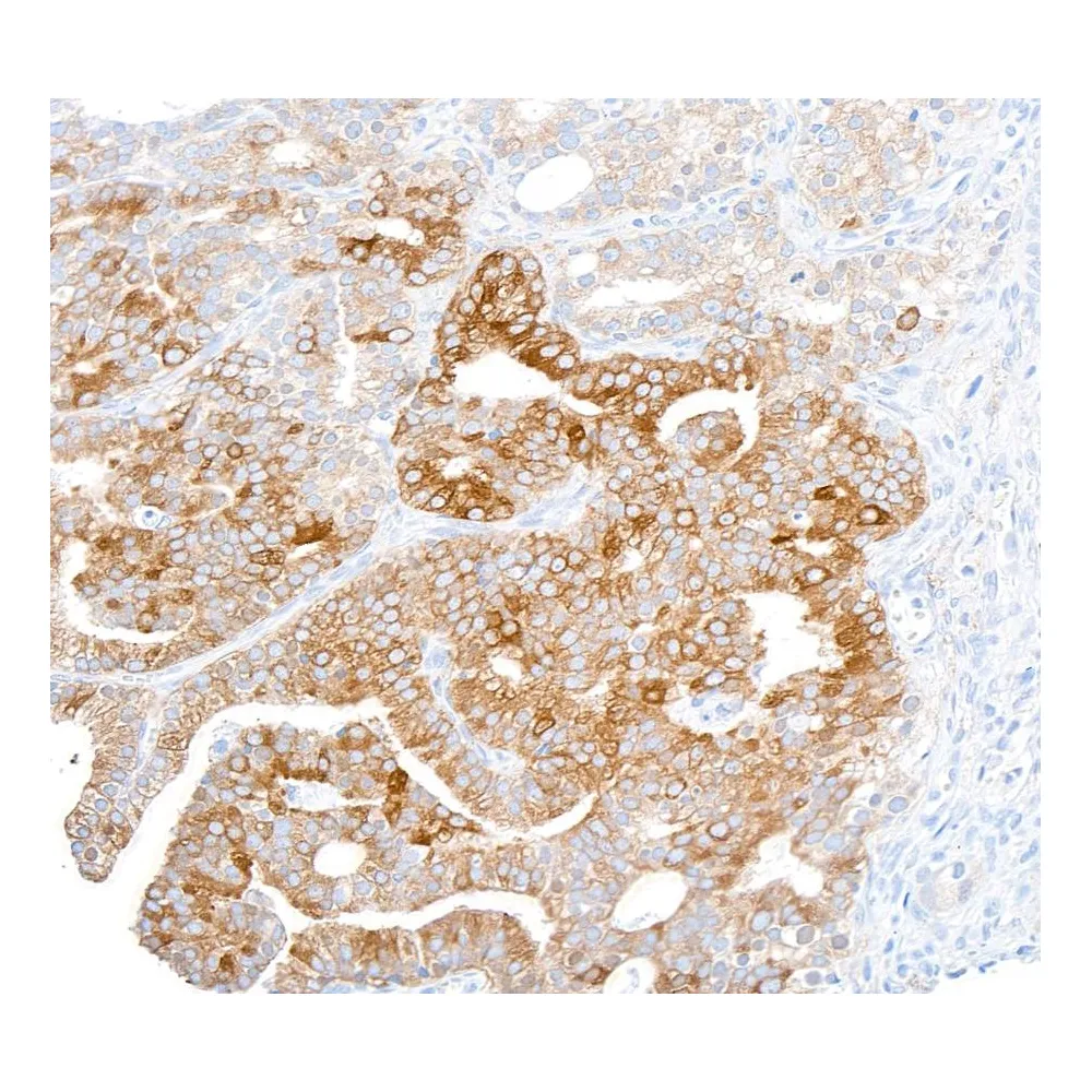 Rabbit anti-FASN Antibody, Affinity Purified